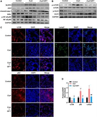 Activation of Autophagy Through the NLRP3/mTOR Pathway: A Potential Mechanism for Alleviation of Pneumonia by QingFei Yin